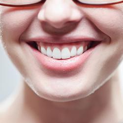 Luxora Facial Tooth Cover Retainer for a Perfect Smile