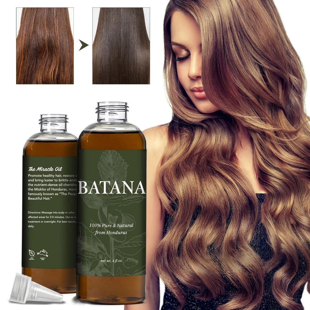 RoyaleGlow Batana Hair Growth Oil Scalp Moisturizer Concentrate