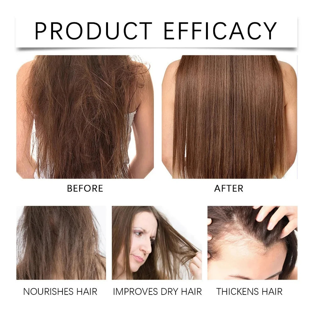 RoyaleGlow Batana Hair Growth Oil Scalp Moisturizer Concentrate