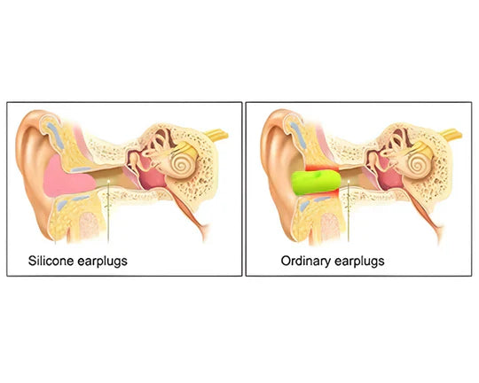 Luxora Best Ear Plugs for Snoring – Noise Reducing Earplugs