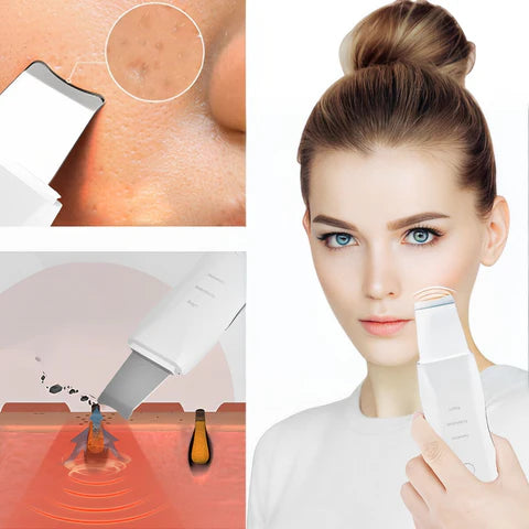 RoyaleGlow Top-Rated Ultrasonic Skin Scrubber Spatula