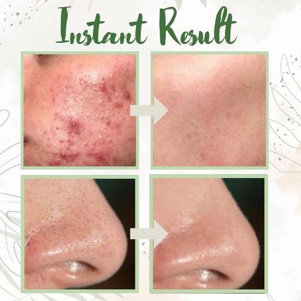 RoyaleGlow Green Tea Clay Deep Cleanse Mask Stick