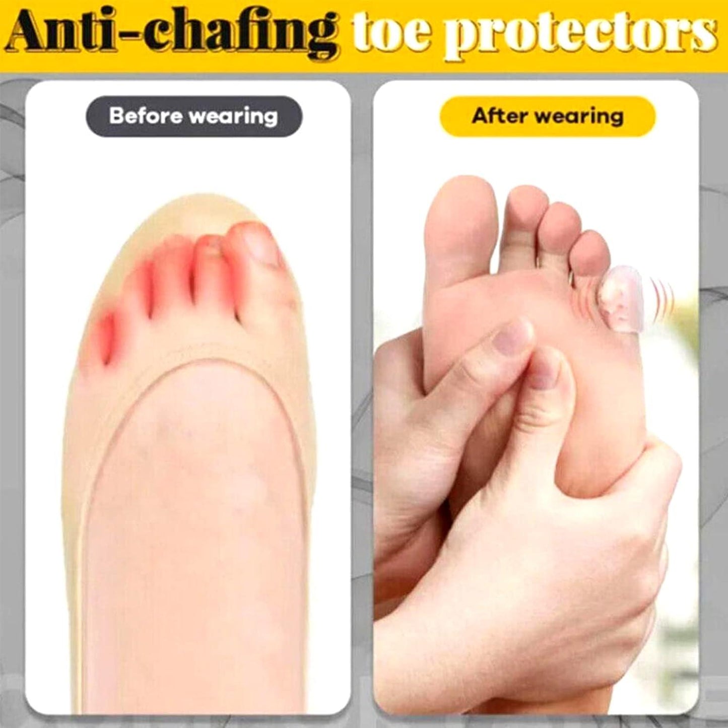 Royaleva Silicone Toe Protectors for Pain Relief Comfort