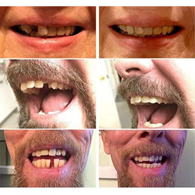 Luxora High-Quality False Teeth for Natural Smiles