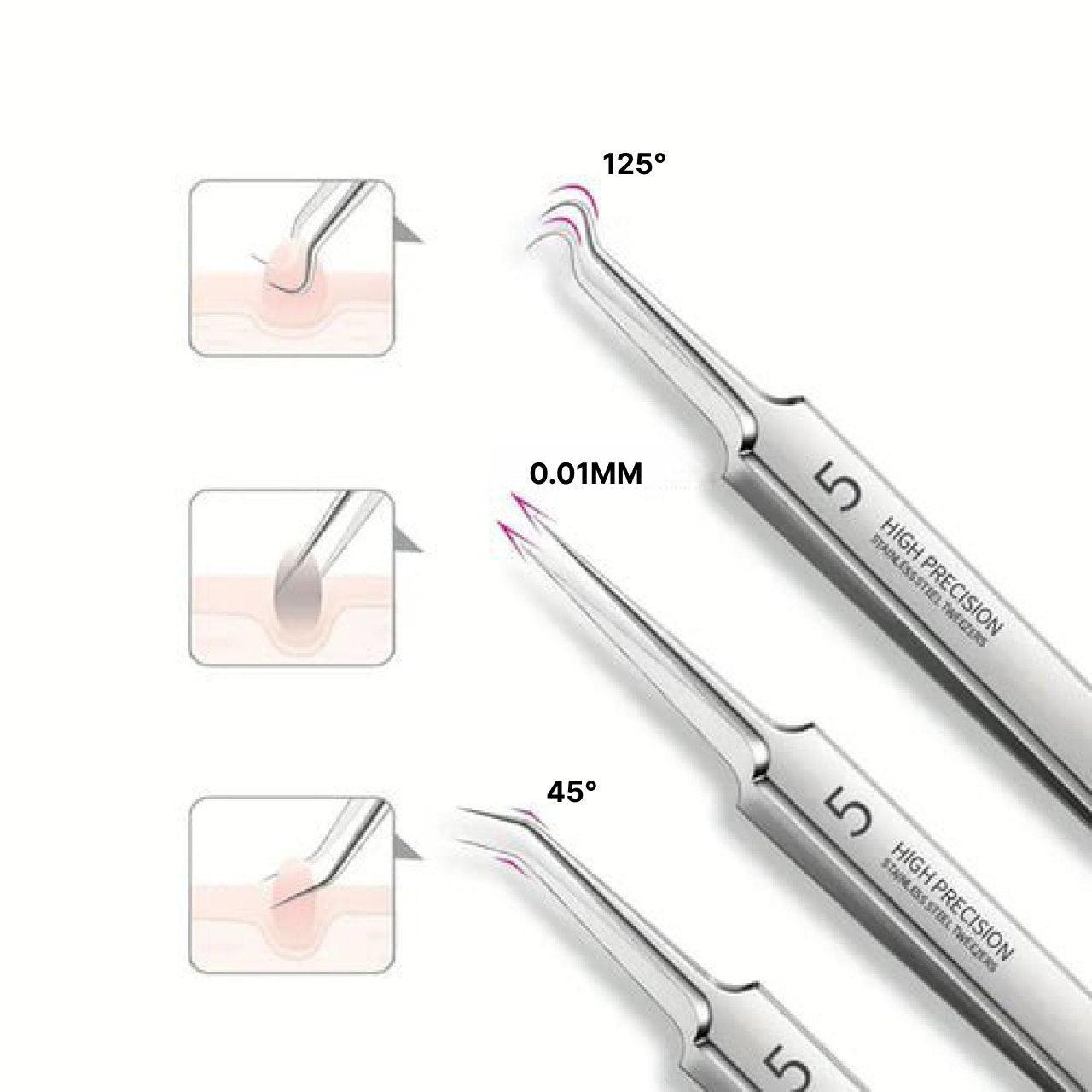 Luxora Blackhead Pliers - Anti Blackhead Kit Set 3 Pcs