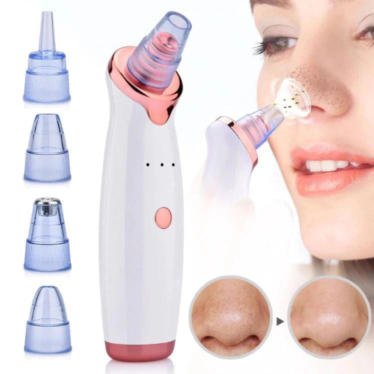 Luxora Blackhead Vacuum Cleaner for Clearer Skin