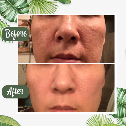 RoyaleGlow Green Tea Clay Deep Cleanse Mask Stick