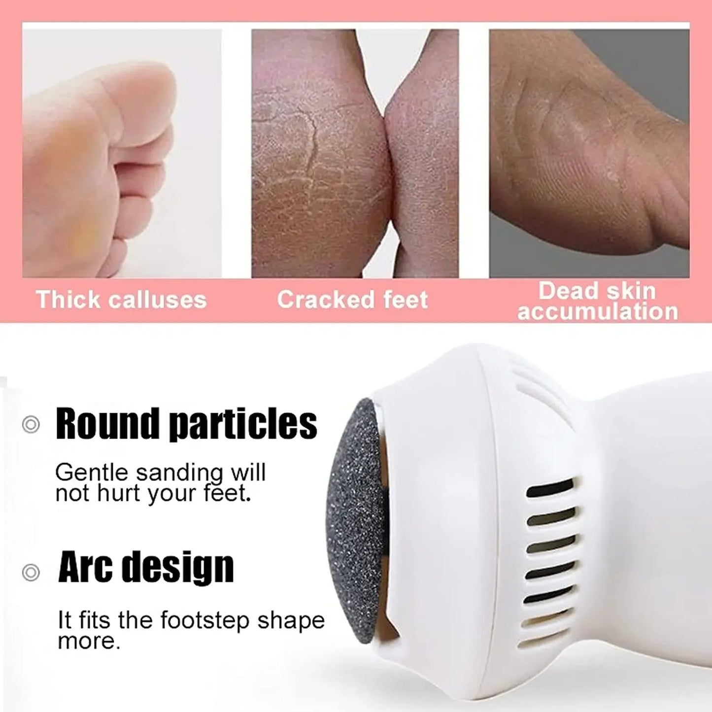 Royallure Electric Foot Callus Remover with Vacuum Function - Rechargeable Pedicure Tool for Smooth Feet and Easy Dead Skin Removal