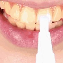 RoyaleGlow Magic Natural Tooth Whitening Gel Pen 50ml