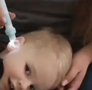 Royaleva Ear Cleaning Vacuum for Gentle Wax Removal