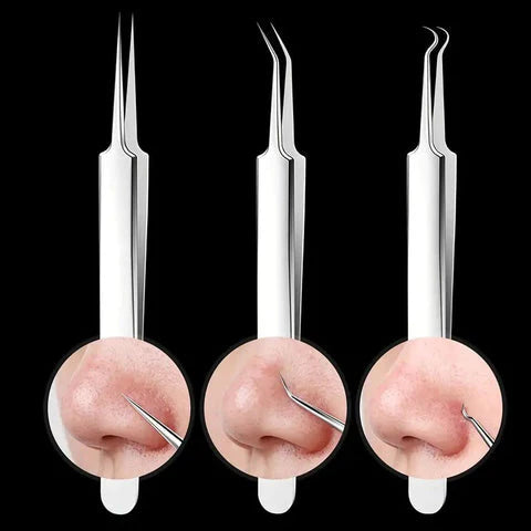 Luxora Blackhead Pliers - Anti Blackhead Kit Set 3 Pcs