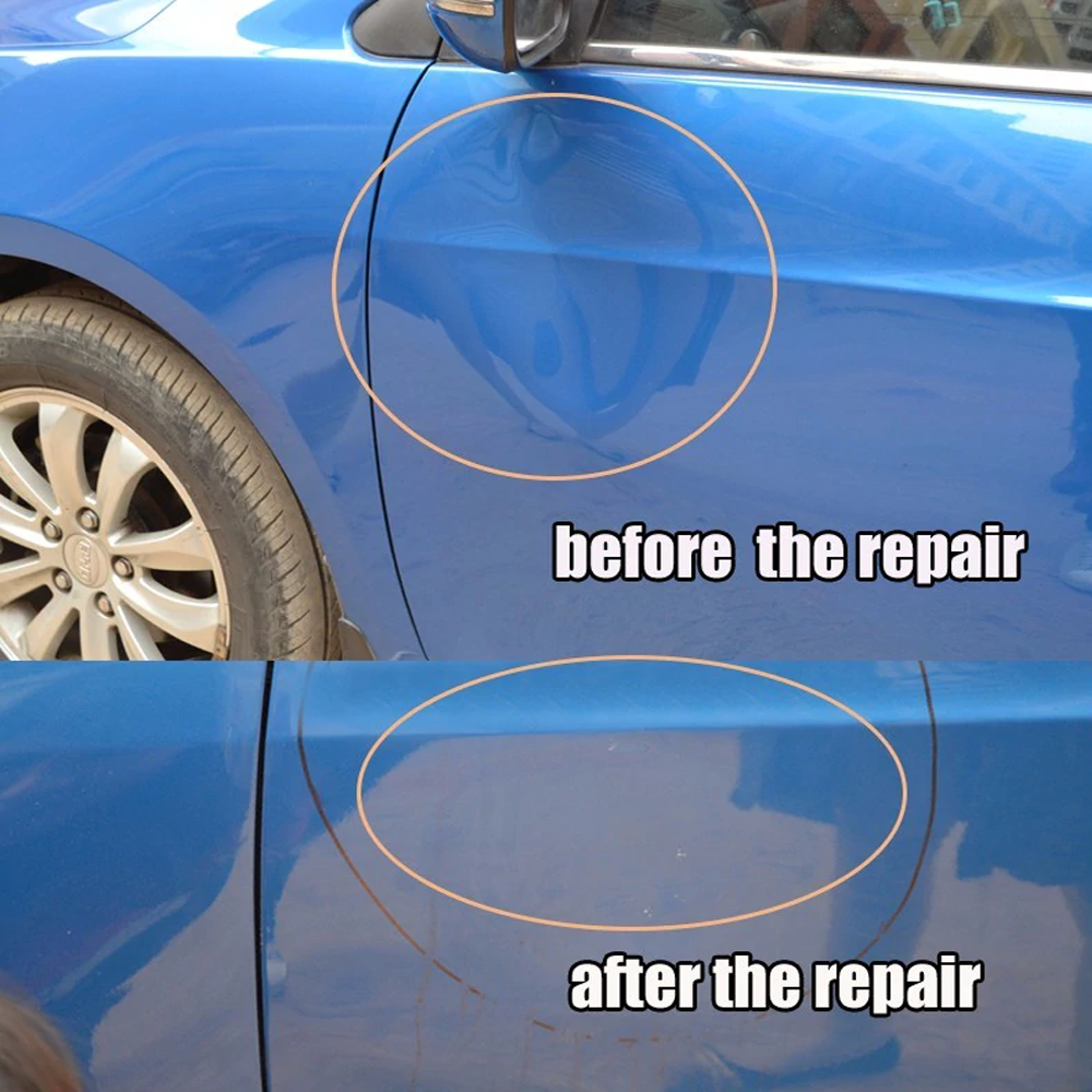 Royaleva Easy DIY Car Dent Removal Tool Kit for Quick Repairs