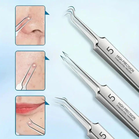 Luxora Blackhead Pliers - Anti Blackhead Kit Set 3 Pcs