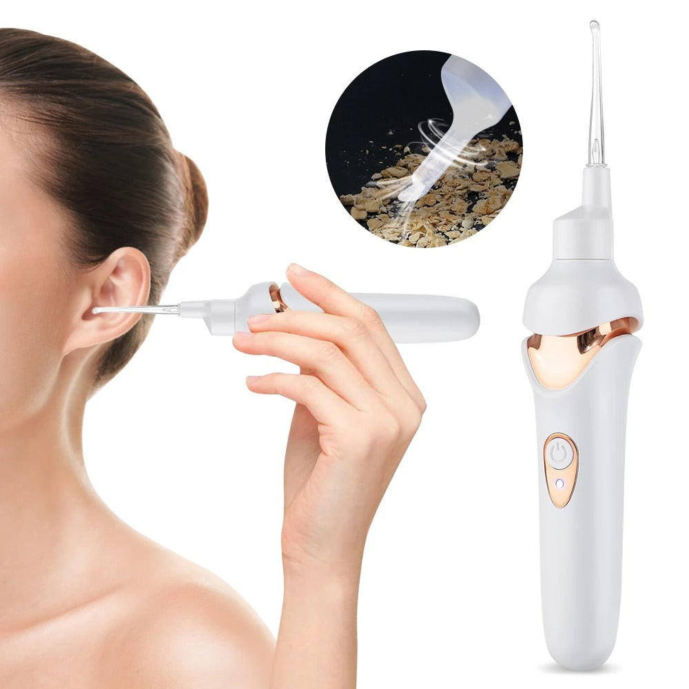 RoyaleGlow Ear Wax Remover with LED Light for Safe Cleaning