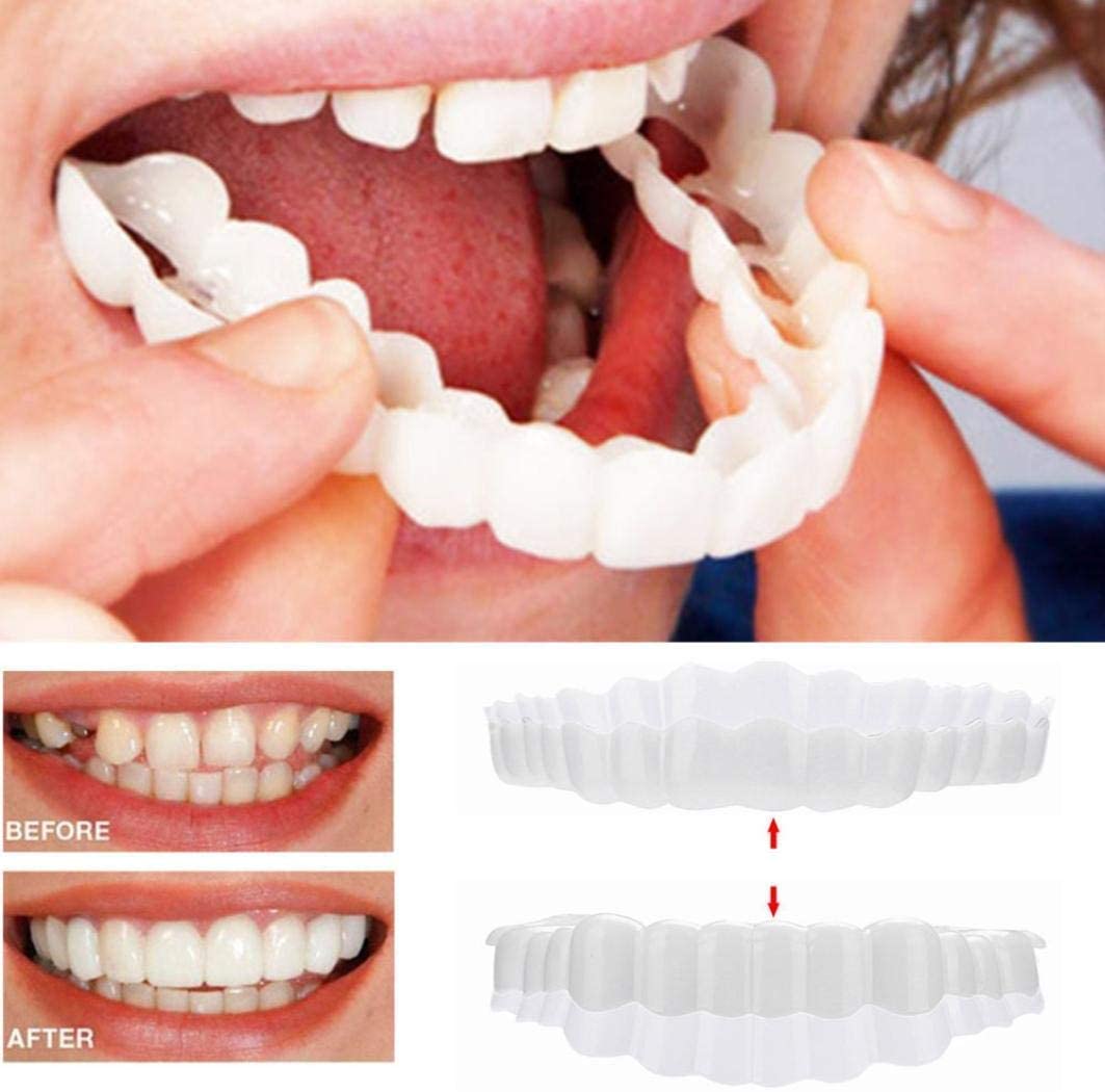 RoyaleGlow Smile Veneer (Upper & Lower Included) Set
