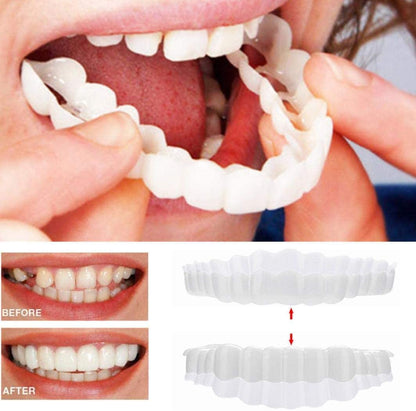 RoyaleGlow Smile Veneer (Upper & Lower Included) Set