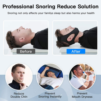 RoyaleGlow Anti Snoring Chin Strap for Sleep Apnea Comfort