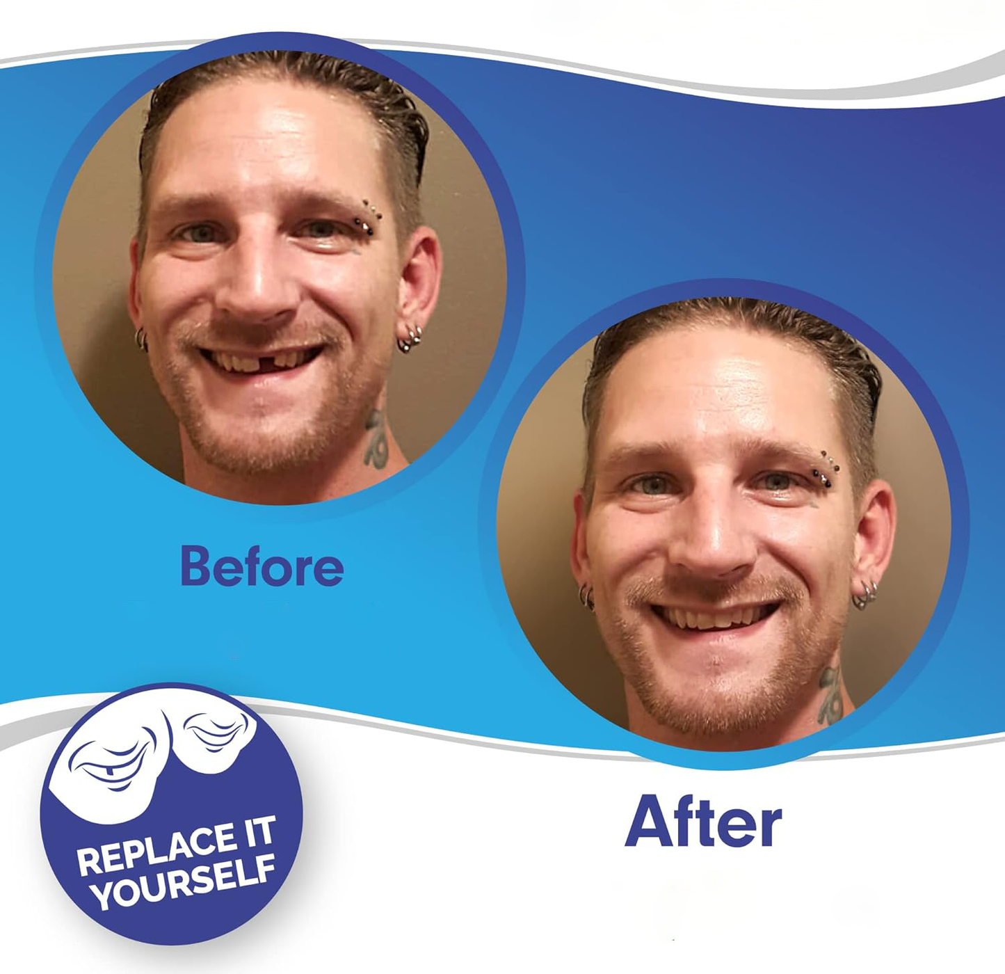 RoyaleGlow Smile Veneer (Upper & Lower Included) Set