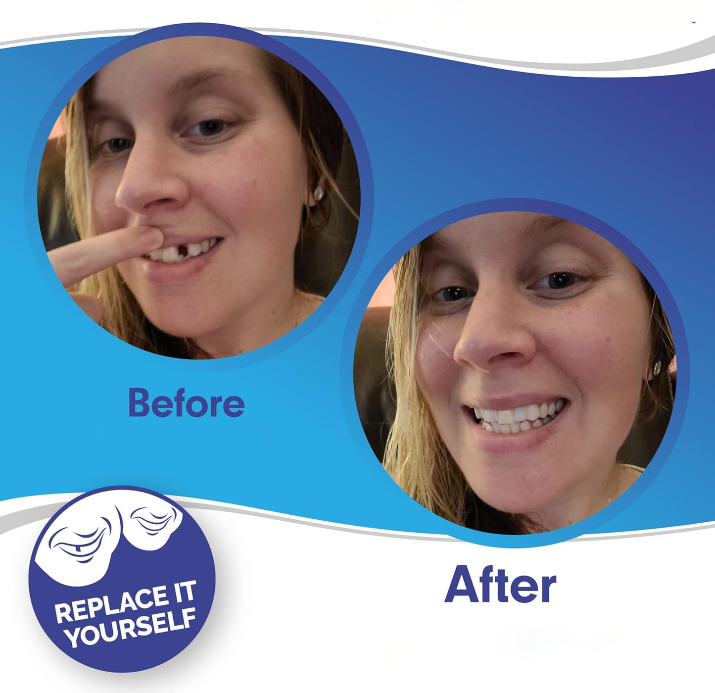 RoyaleGlow Smile Veneer (Upper & Lower Included) Set
