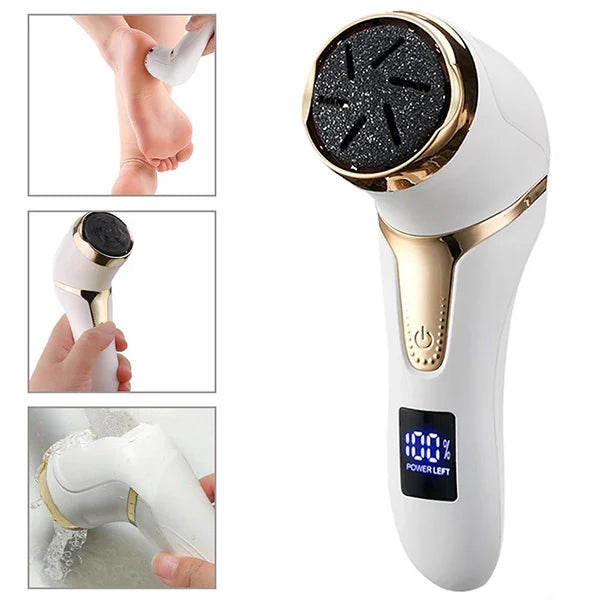 Royaleva Vacuum Callus Remover with Rechargeable Battery