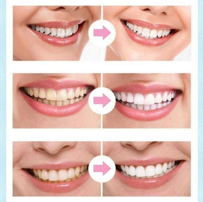RoyaleGlow Dental Whitening Pen for Fast Teeth Brightening