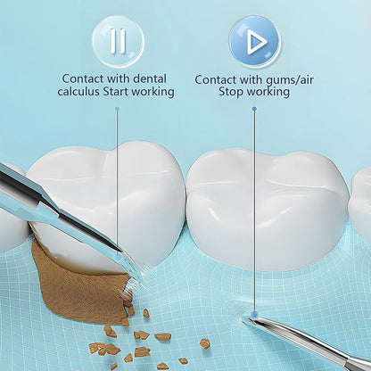 Royaleva Ultrasonic Scaling Wand for Efficient Tooth Cleaning