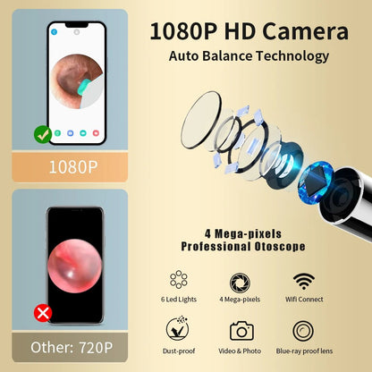 Royaleva Ear Cleaning Picker With Camera 1080p HD View