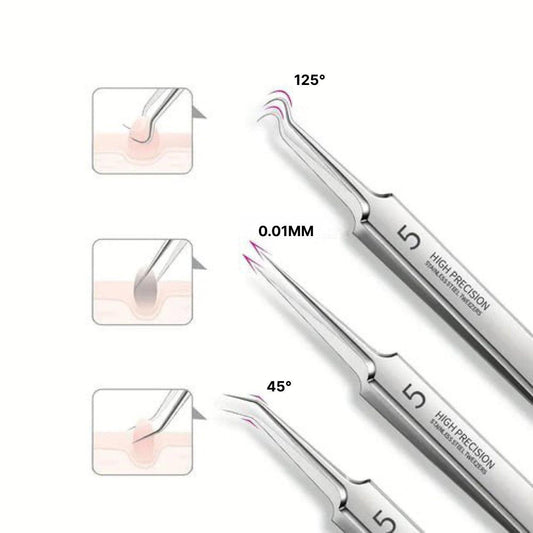 Luxora Blackhead Pliers - Anti Blackhead Kit Set 3 Pcs
