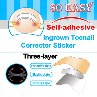 Royaleva Easy Patches - Correction Patches For Beautiful And Healthy Nails