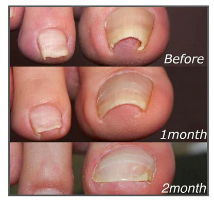 Royaleva Easy Patches - Correction Patches For Beautiful And Healthy Nails