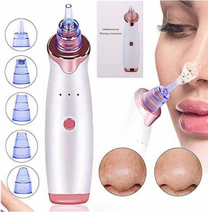 Luxora Blackhead Vacuum Cleaner for Clearer Skin