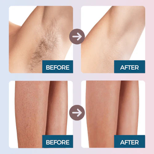 Rayvia Pain-Free Two-In-One Portable Hair Removal Trimmer For Gentle Everyday Grooming