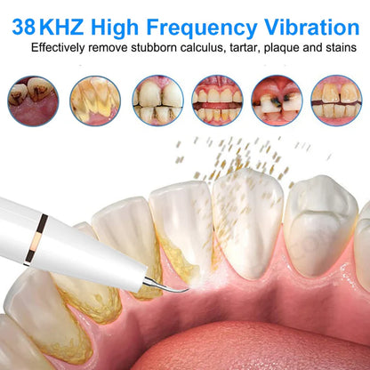 Royaleva Ultrasonic Scaler Plaque Remover for Home Use