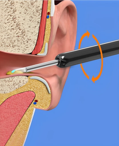 Luxora EarBit 3000 - Ear Cleaning Tool With a Camera