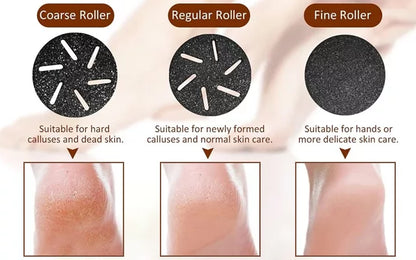 Royaleva Vacuum Callus Remover with Rechargeable Battery