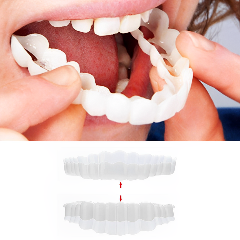 RoyaleGlow Smile Veneer (Upper & Lower Included) Set
