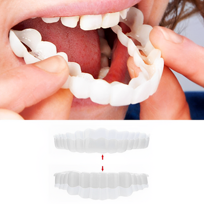 RoyaleGlow Smile Veneer (Upper & Lower Included) Set
