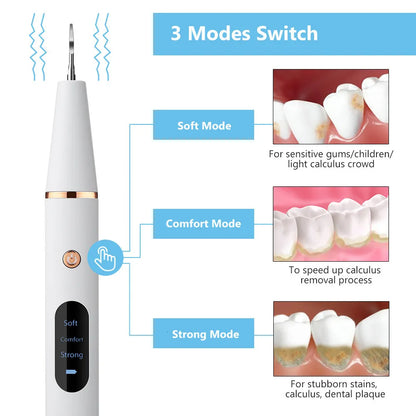 Royaleva Ultrasonic Scaling Wand for Efficient Tooth Cleaning