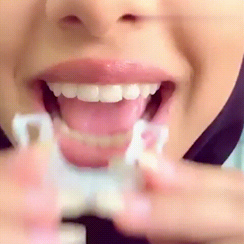 RoyaleGlow Smile Veneer (Upper & Lower Included) Set