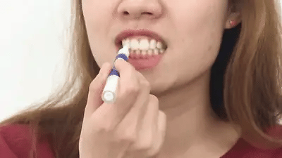 RoyaleGlow Dental Whitening Pen for Fast Teeth Brightening