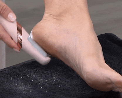 RoyaleGlow Rechargeable Electric Foot File Callus Remover