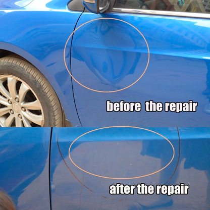Royaleva Easy DIY Car Dent Removal Tool Kit for Quick Repairs