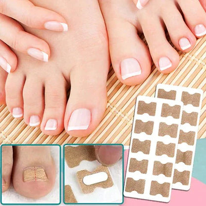 Royaleva Easy Patches - Correction Patches For Beautiful And Healthy Nails