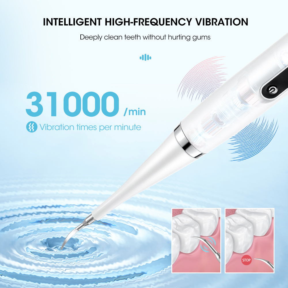 Royaleva Dental Tartar Removal Teeth Cleaner Tool 55x
