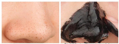Luxora Blackhead Mask for Clearer, Radiant Skin 50g