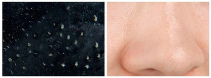 Luxora Blackhead Mask for Clearer, Radiant Skin 50g