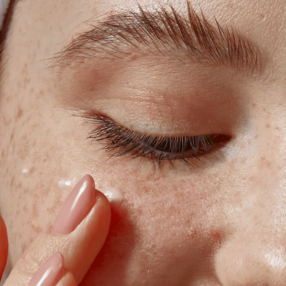 RoyaleGlow Eye Milia Removal Cream for Youthful Skin