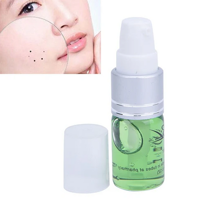 Luxora Moles Formula Natural Cream for Mole Removal