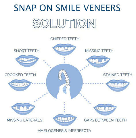 RoyaleGlow Smile Veneer (Upper & Lower Included) Set