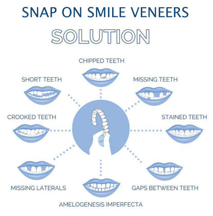 RoyaleGlow Smile Veneer (Upper & Lower Included) Set